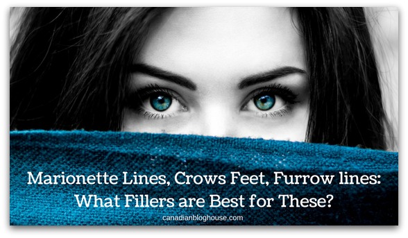 What Dermal Fillers Are Best For Marionette Lines, Crows Feet & Furrows